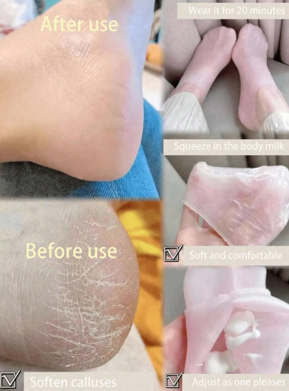 Silicone Gel Moisturizing Heel Socks
