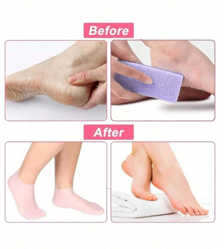 Silicone Gel Moisturizing Heel Socks